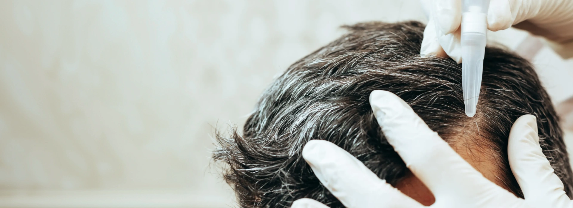 Regain your hair, regain your confidence
