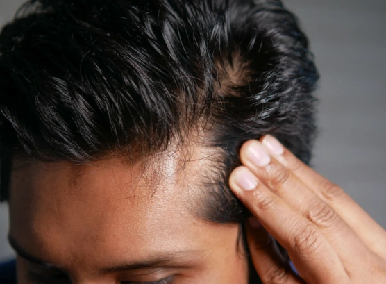 Your treatment process