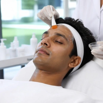 Chemical Peels